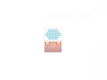 1550nm Laser for Skin Tightening, Wrinkle Removal and Scar Reduction L1550